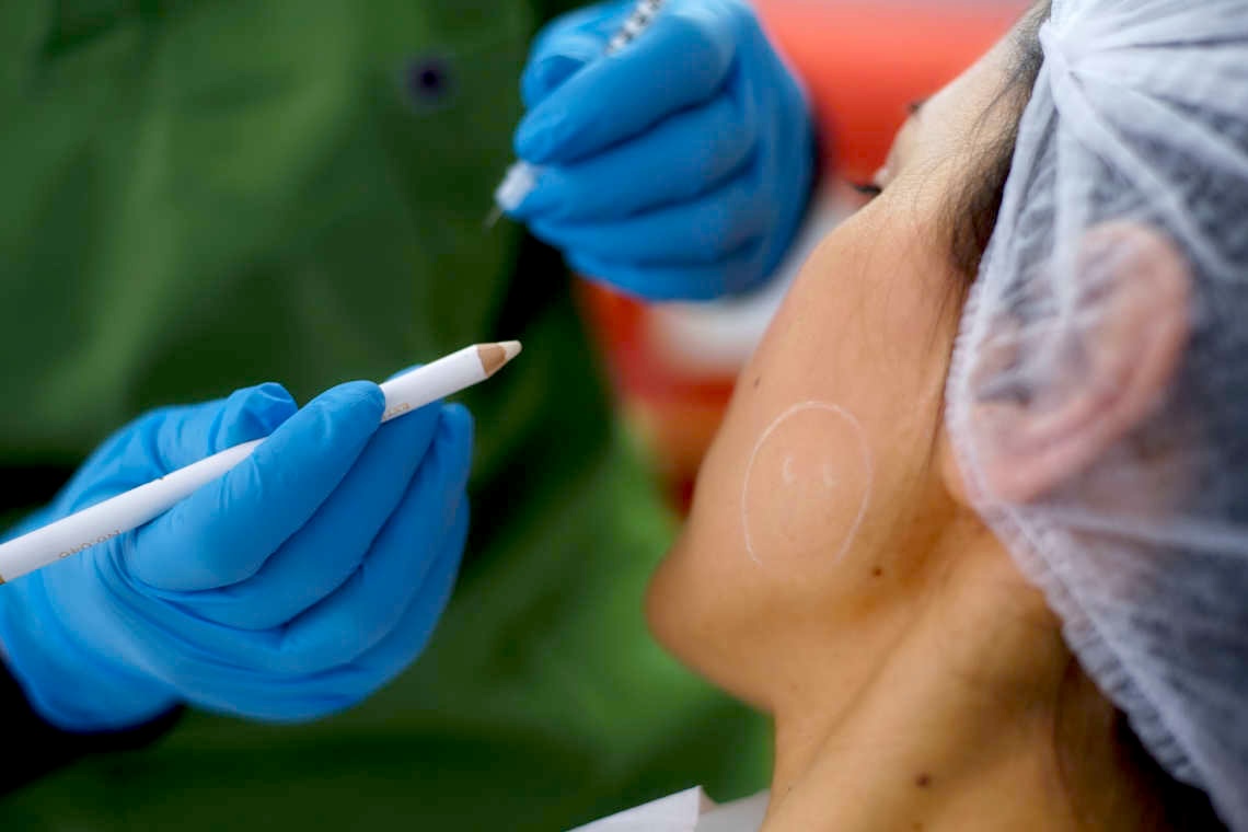 Botox and Fillers Market Research